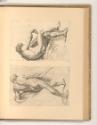 Druckgrafiken nach Pierre und Nicolas Mignard, Figurenstudie, Inv. Nr.: Frankreich nach Sektion…